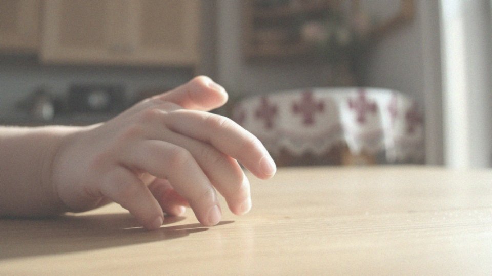 Białe plamki na paznokciach u dzieci – przyczyny i leczenie